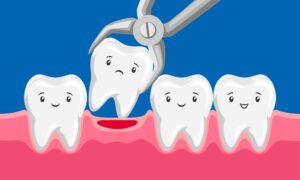 Illustration of one sad tooth being removed from a row of happy ones